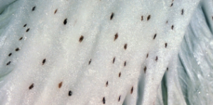 Pieprzowa plamistość kapusty - brązowe zmiany na liściach