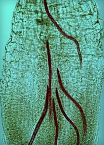 Second-stage juveniles of root-knot nematode, Meloidogyne sp., penetrating tomato root tip. (Courtesy of Jonathan D. Eisenback, Virginia Polytechnic Institute and State University, Bugwood.org)